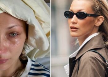 Bella Hadid kthehet pas qëndrimit në spital