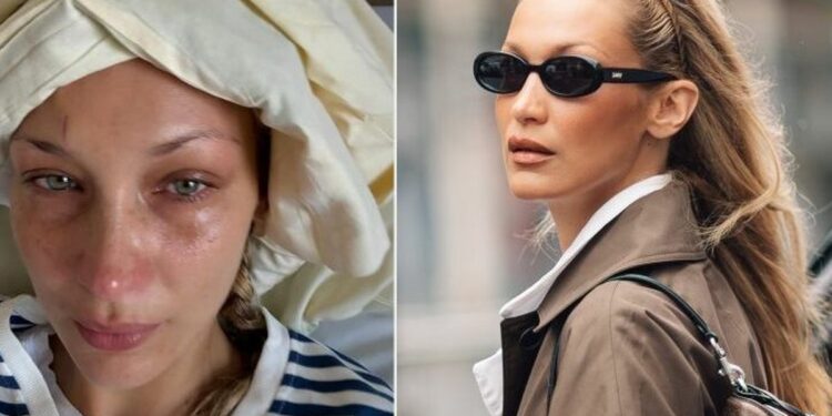 Bella Hadid kthehet pas qëndrimit në spital