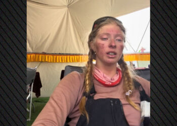 Kaloi 4 ditë në “Zonën e Vdekjes”, 17-vjeçarja befasuese me pamjen pas ngjitjes në Everest
