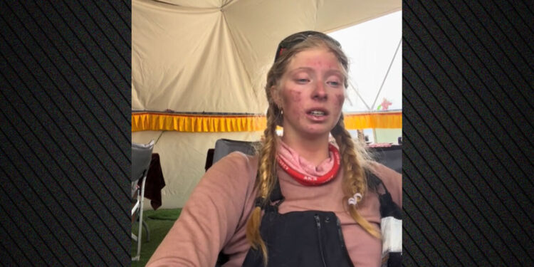 Kaloi 4 ditë në “Zonën e Vdekjes”, 17-vjeçarja befasuese me pamjen pas ngjitjes në Everest