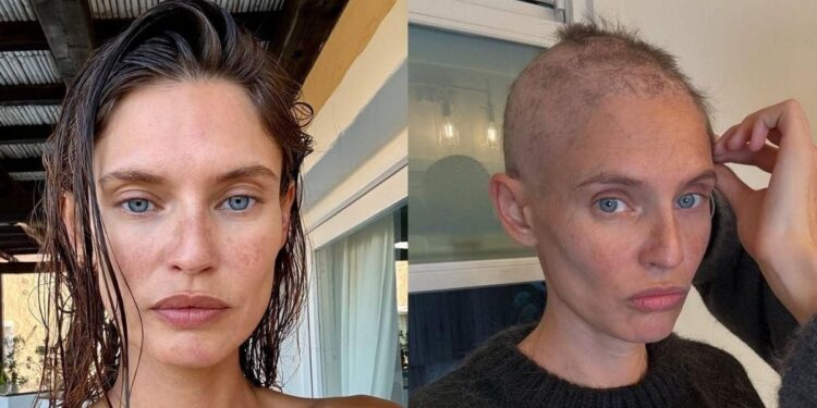 Pas një sëmundjeje të rëndë, modelja e njohur rikthehet në botën e modës!