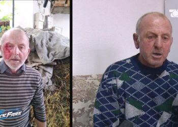 Fiks Fare: Familja në Devoll përballet me dhunë, policia nuk merr masa ndaj autorit. Ekspertiza e mjekut ligjor vonohet!