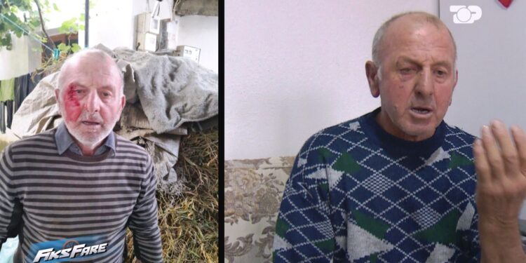 Fiks Fare: Familja në Devoll përballet me dhunë, policia nuk merr masa ndaj autorit. Ekspertiza e mjekut ligjor vonohet!