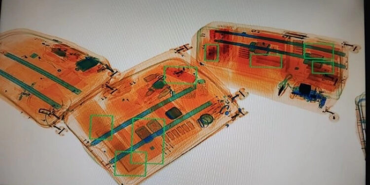 Ndalohen pajisjet për transplantin e flokëve në Aeroportin "Adem Jashari"