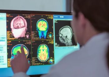 Rinia zgjat deri në të 30-at, një studim i ri identifikon katër faza të rëndësishme të zhvillimit të trurit.