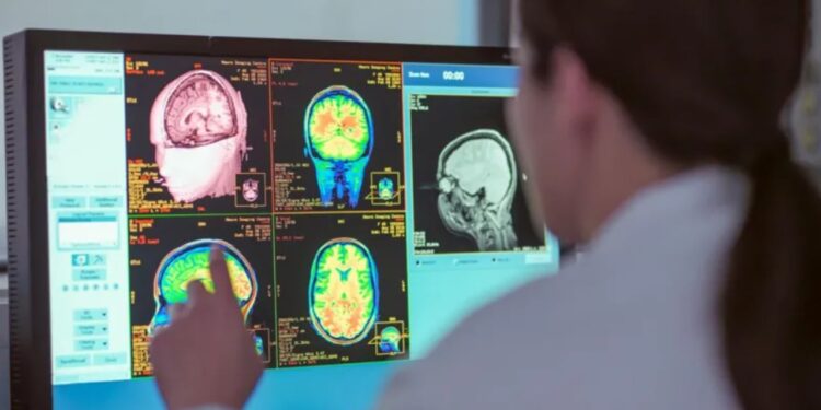 Rinia zgjat deri në të 30-at, një studim i ri identifikon katër faza të rëndësishme të zhvillimit të trurit.