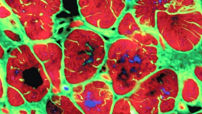 Studimi: Një gjen miqësor për zemrën ndihmon në rikuperimin pas një infarkti kardiak.