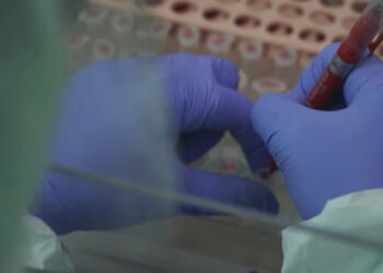 Në mesin e pacientëve me simptoma të gripit sezonale, janë identifikuar 20 raste pozitive me COVID-19.