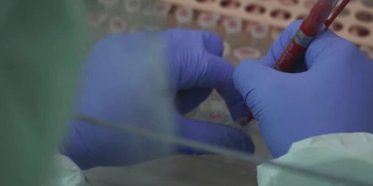 Në mesin e pacientëve me simptoma të gripit sezonale, janë identifikuar 20 raste pozitive me COVID-19.