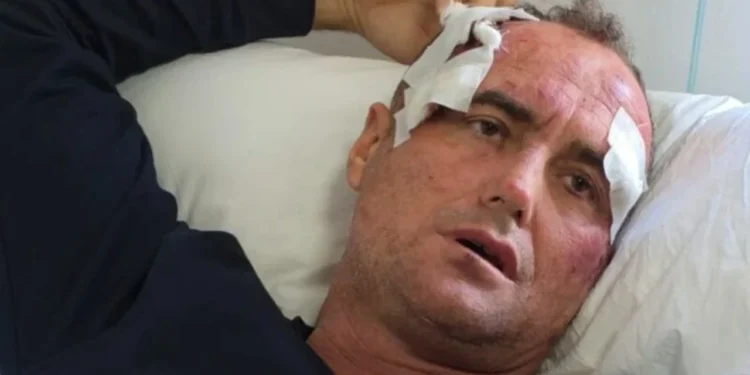 46-vjeçari nga Fieri: 'Njerëz me uniforma policie më sulmuan në shtëpinë time, kërkoj drejtësi'