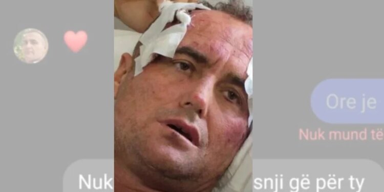 Mos ki frikë nga unë, të pres në Vjosë" - Zbulohen mesazhet, këto janë ato që 46-vjeçari i shkruante motrës së policit në Fier: "Të dëshiroj si i çmendur, pse i the Fredit…