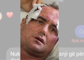 Motra e 46-vjeçarit të dhunuar reagon pas publikimit të mesazheve private: Mjaft me këtë telenovelë, nuk kërkojmë hakmarrje, por…