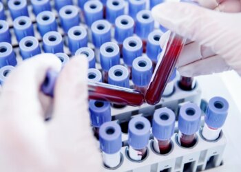 Njoftohuni me Rh-null, ‘gjakun e artë’ që ka tërhequr vëmendjen e madhe të shkencëtarëve për riprodhimin e tij në laborator.