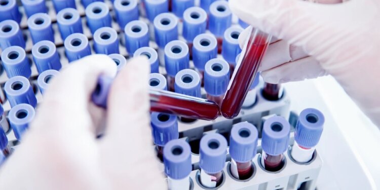 Njoftohuni me Rh-null, ‘gjakun e artë’ që ka tërhequr vëmendjen e madhe të shkencëtarëve për riprodhimin e tij në laborator.