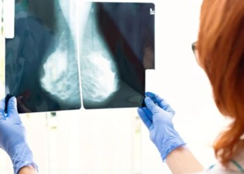 Revolucioni në trajtimin e kancerit të gjirit: Testi i studiuesve britanikë parashikon terapinë më efektive për çdo pacient.