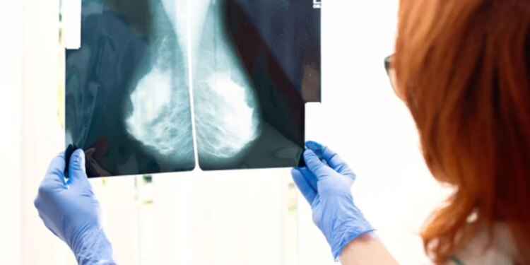 Revolucioni në trajtimin e kancerit të gjirit: Testi i studiuesve britanikë parashikon terapinë më efektive për çdo pacient.