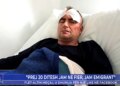 "‘Like’ kam bërë disa herë, komenti ishte…”, 46-vjeçari nga Fier sulmohet nga policia: Motra e tij nuk më përgjigjej, tregon për ‘Shqipëria Live’