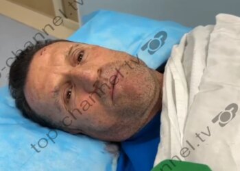 Avokati Cakrani tregon për TCH: U sulmova nga dy individë në një pikë karburanti, njëri më ofendoi dhe tjetri më goditi me një mjet prerës.