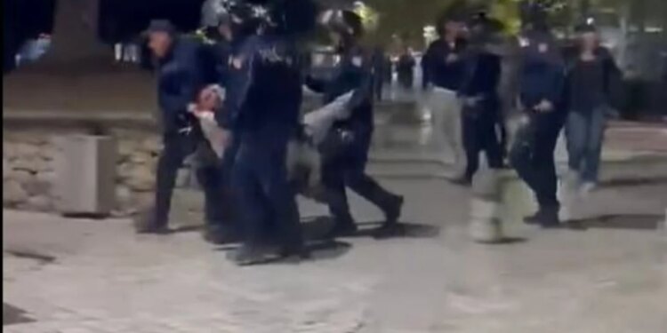 Dëmtimi i këmbës së 19-vjeçarit gjatë protestës, Policia e Shtetit pranon përdorimin e forcës dhe pezullon 4 agjentë e shefin e komisariatit nr. 1.